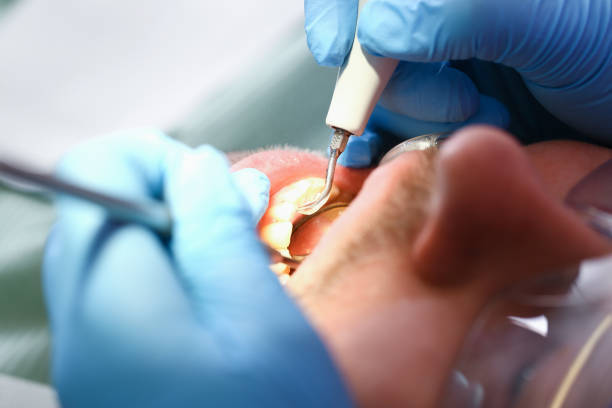 Best Weekend Emergency Dentist in East Falmouth, MA